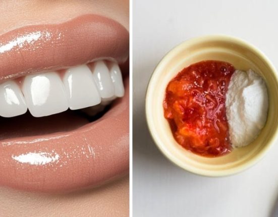 وصفات ناجحة لتبييض الأسنان والحصول على ابتسامة مشرقة