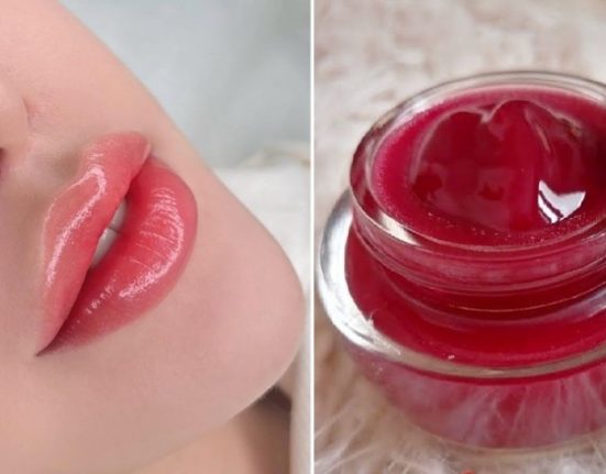 توريد الشفتين طبيعيا وتكبيرها وتحسين مظهرها بطريقة آمنة