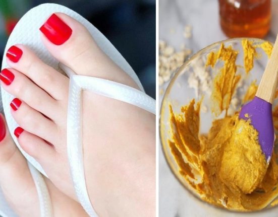 تبييض الأقدام طبيعيا لاستعادة النعومة والإشراق