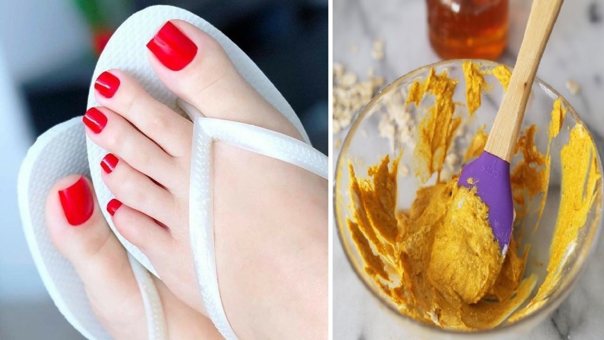 تبييض الأقدام طبيعيا لاستعادة النعومة والإشراق